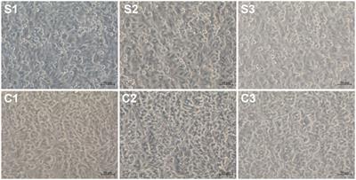 Comparative transcriptomics analysis on Senecavirus A-infected and non-infected cells